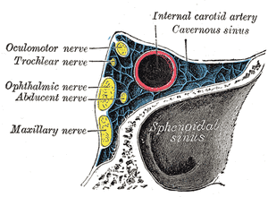 Anatomischer Querschnitt, englisch beschriftet: im Sinus cavernosus die innere Halsschlagader (rot) und die Hirnnerven III, IV, V1, V2 und VI (gelb), darunter die Keilbeinhöhle.